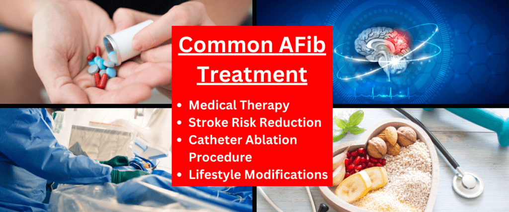 El tratamiento común para la FA incluye medicamentos, procedimientos y modificaciones en el estilo de vida.