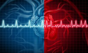 Fibrillation auriculaire et rythme cardiaque anormal