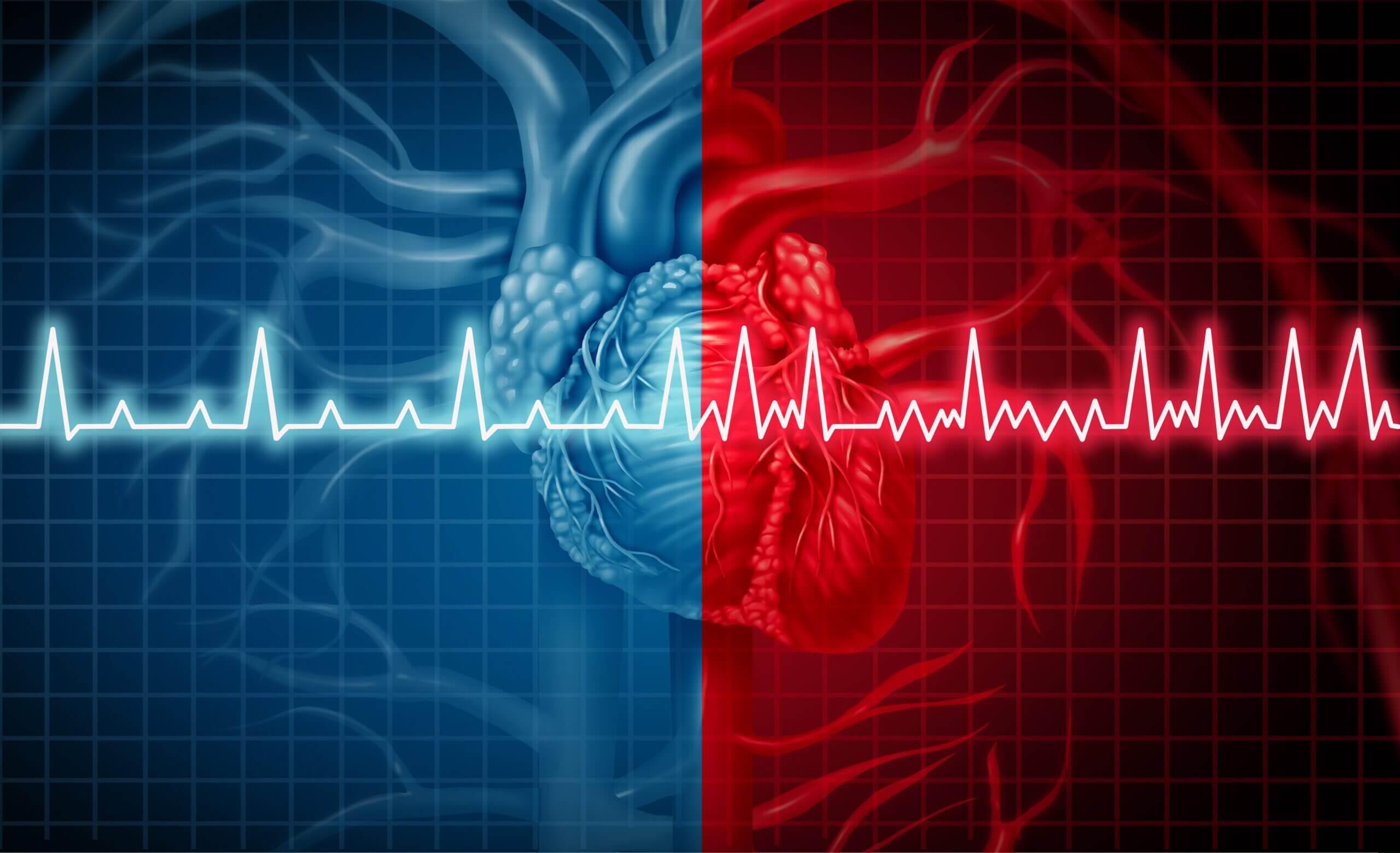 ภาวะหัวใจห้องบนและจังหวะการเต้นของหัวใจผิดปกติ