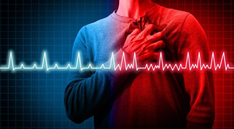 Top AFib Triggers You Need to Know: Managing Atrial Fibrillation