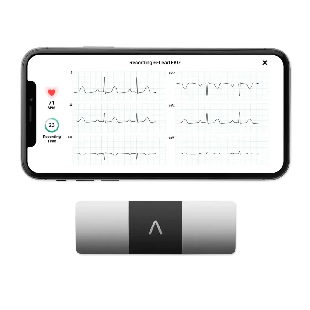 kardiamobile 6L mit EKG